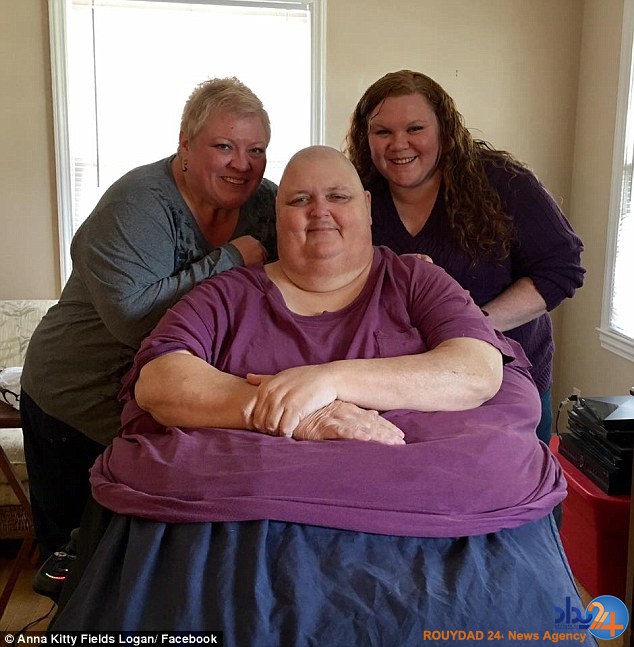 تومور 65 کیلویی در شکم فروشنده آمریکایی (تصاویر)
