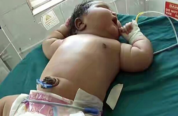 نوزاد 7 کیلویی رکورد سنگین وزن ترین کودک دنیا را زد (تصاویر)