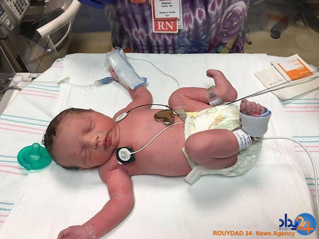 نوزادی که دو بار به دنیا آمد (تصاویر)