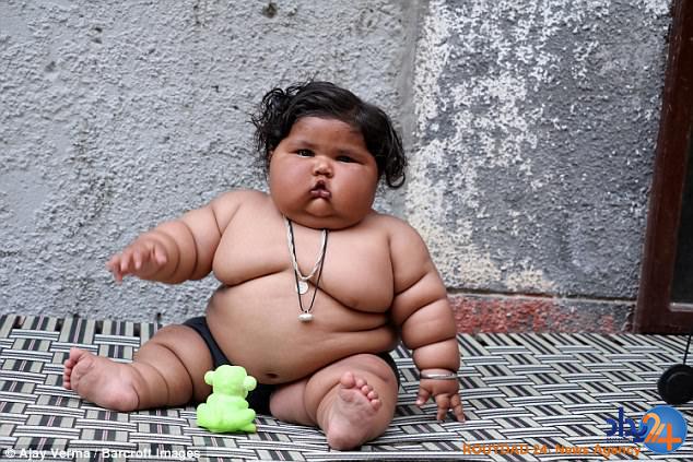 دختر 8 ماهه با 12 کیلو وزن پزشکان را گیج کرده است (تصاویر)