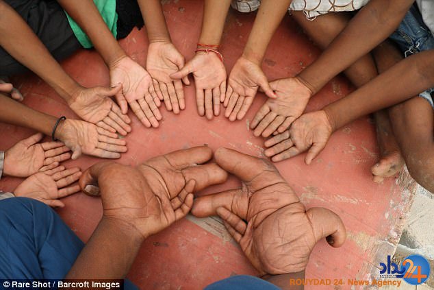 دست‌های عجیب پسر هندی (فیلم و تصاویر)