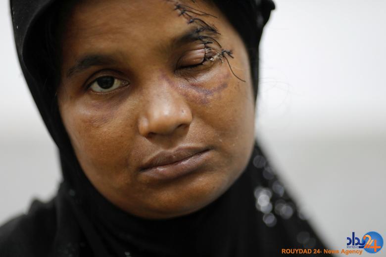 چهره روهینگیا (تصاویر)