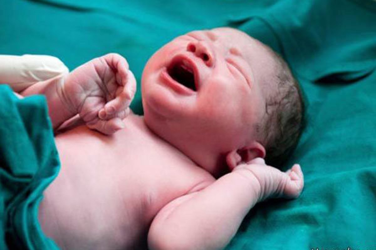 تاریخ تولد لاکچری و بروز مشکل تنفسی در نوزادان