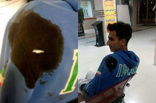 حمله زورگیران به دونده تیم ملی (عکس) حمله زورگیران به دونده تیم ملی (عکس)