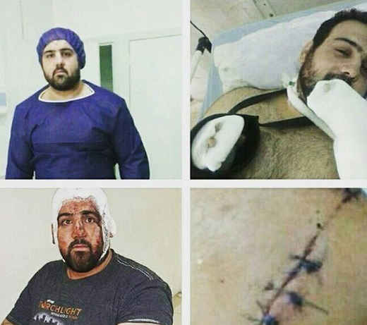 ضرب و شتم ملی پوش جودو (عکس) ضرب و شتم ملی پوش جودو (عکس)