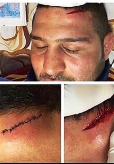 مصدومیت شدید پلنگ جویبار در تمرینات (عکس) مصدومیت شدید پلنگ جویبار در تمرینات (عکس)