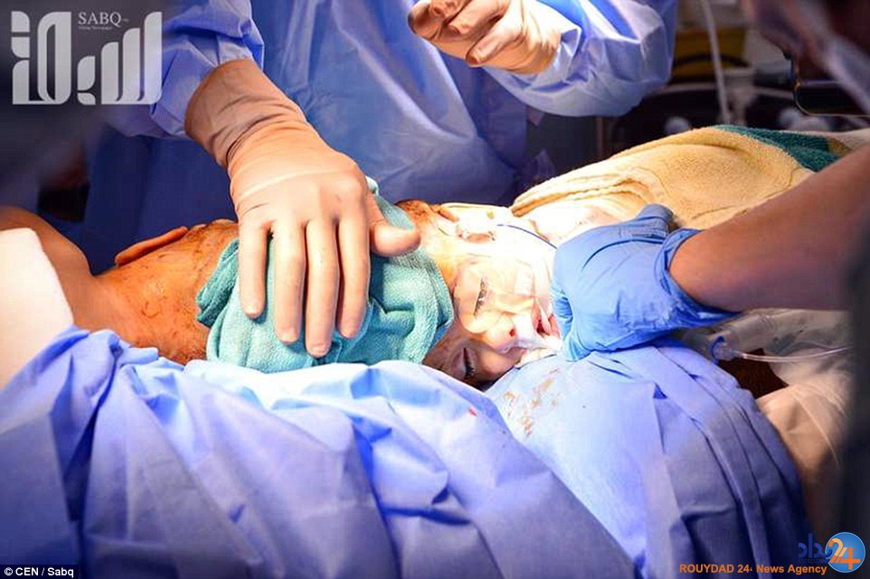 دوقلوهای سوری پس از چهار سال از هم جدا شدند (تصاویر) دوقلوهای سوری پس از چهار سال از هم جدا شدند (تصاویر)