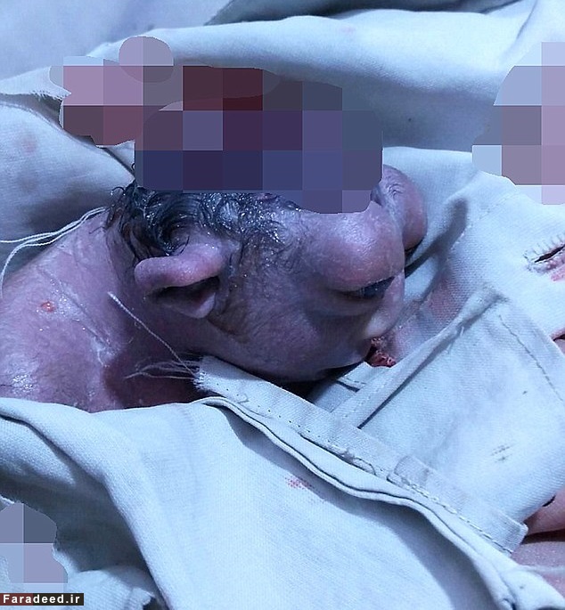 تولد دختری عجیب در هند! (تصاویر) تولد دختری عجیب در هند! (تصاویر)