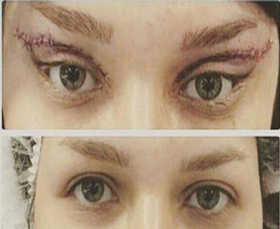 «چشم گربهای» مد جدید بعد از گوش الاغی! (تصویر) «چشم گربهای» مد جدید بعد از گوش الاغی! (تصویر)