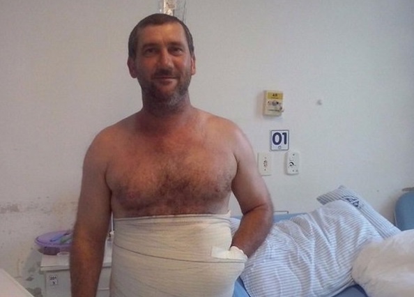 یک عمل جراحی نادر در برزیل (تصاویر) یک عمل جراحی نادر در برزیل (تصاویر)