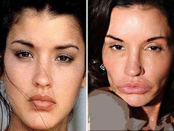 هالیوودی هایی که با جراحی پلاستیک چهره خود را دگرگون کردند