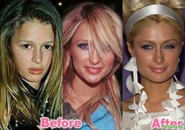 هالیوودی هایی که با جراحی پلاستیک چهره خود را دگرگون کردند