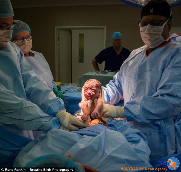 مادر استرالیایی خود را سزارین کرد