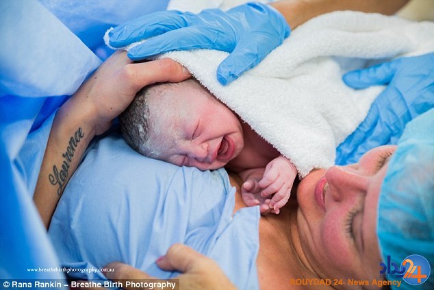 مادر استرالیایی خود را سزارین کرد