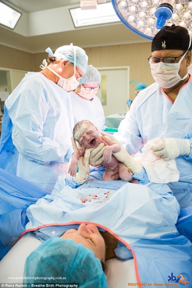 مادر استرالیایی خود را سزارین کرد