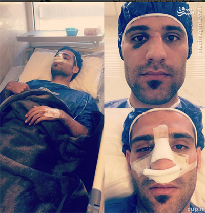 مدافع استقلال زیر تیغ جراحی (تصویر)