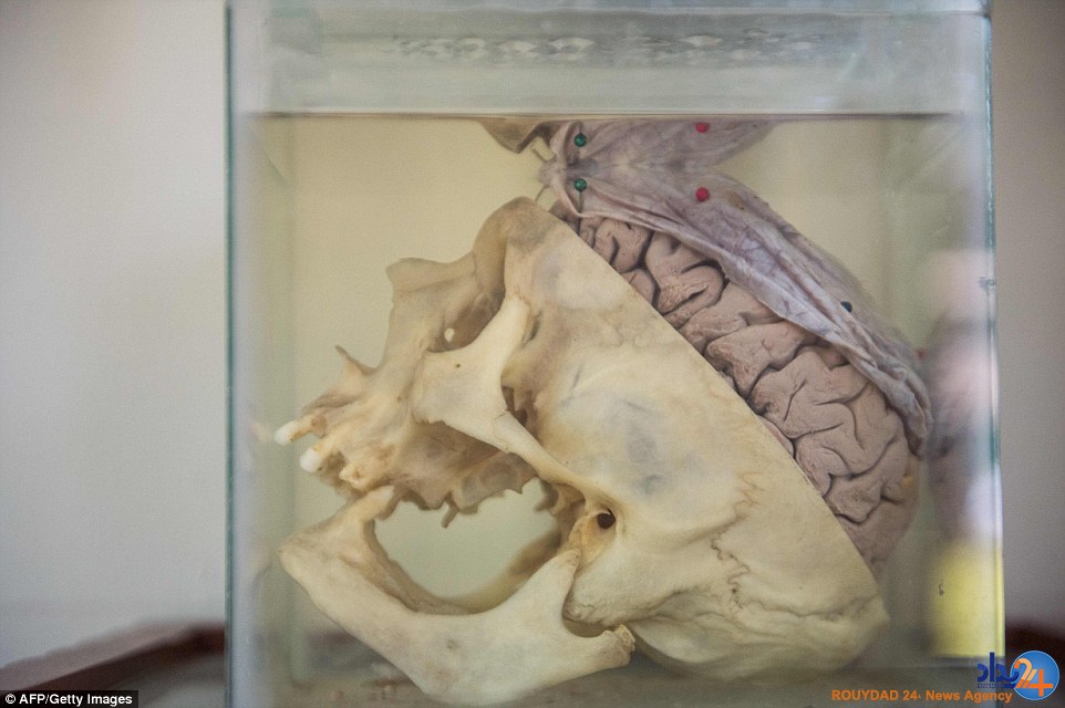 موزه‌ای با 3000 مغز که بیش از 300 سال قدمت دارد (تصاویر)