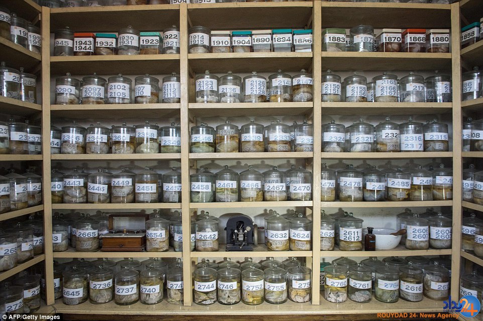 موزه‌ای با 3000 مغز که بیش از 300 سال قدمت دارد (تصاویر)