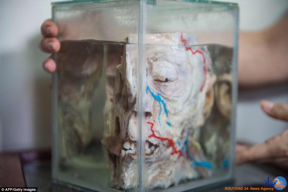 موزه‌ای با 3000 مغز که بیش از 300 سال قدمت دارد (تصاویر)