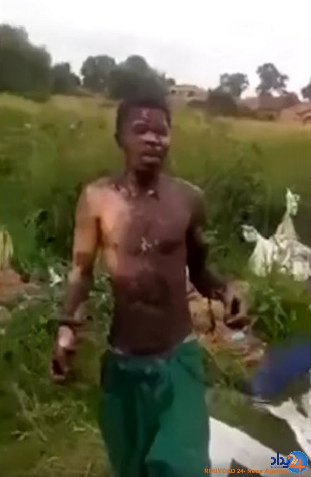 نجات مردی از برق‌گرفتگی 30 هزار ولتی (فیلم و تصاویر 18+)