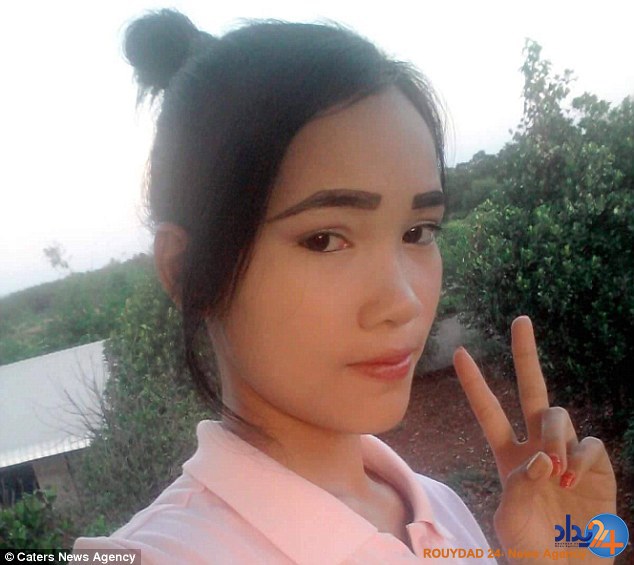 باکتری گوشت‌خوار صورت نوجوان کامبوجی را خورد (تصاویر)