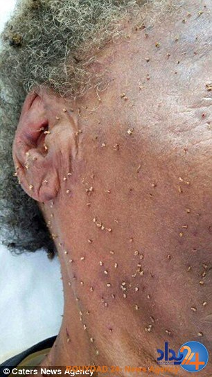 حمله همزمان 500 زنبور جان پیرزن برزیلی را گرفت (تصاویر)