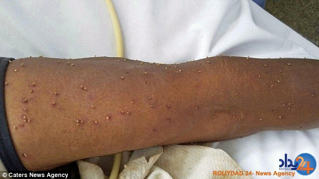 حمله همزمان 500 زنبور جان پیرزن برزیلی را گرفت (تصاویر)