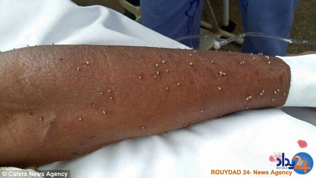 حمله همزمان 500 زنبور جان پیرزن برزیلی را گرفت (تصاویر)