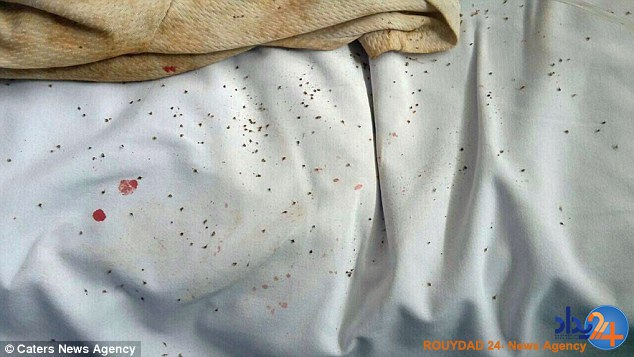 حمله همزمان 500 زنبور جان پیرزن برزیلی را گرفت (تصاویر)