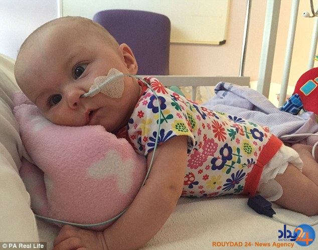 بهبود عجیب نوزادی که دچار اختلال مغزی بود (تصاویر)