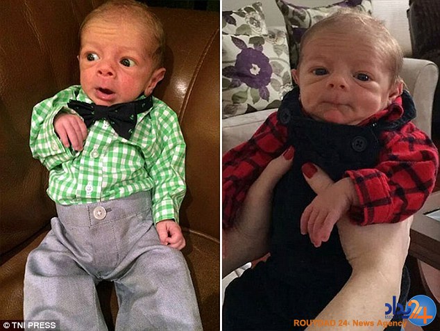 کودکانی که در نوزادی پیر هستند (تصاویر)