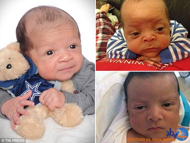 کودکانی که در نوزادی پیر هستند (تصاویر)