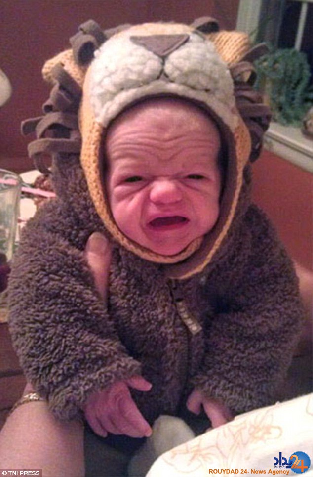 کودکانی که در نوزادی پیر هستند (تصاویر)