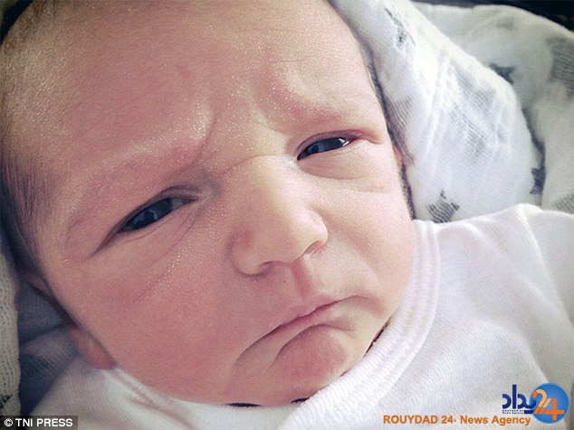 کودکانی که در نوزادی پیر هستند (تصاویر)