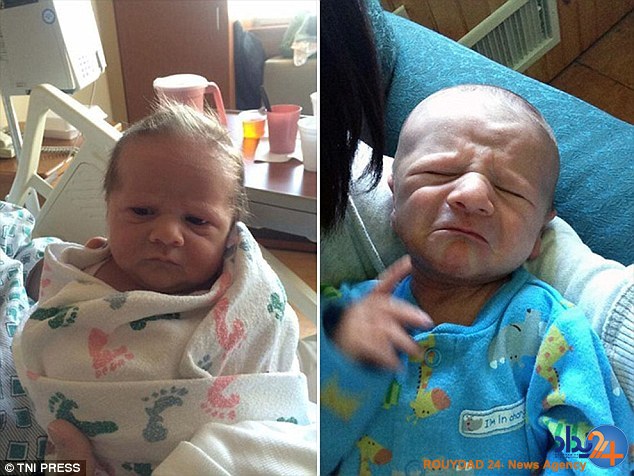 کودکانی که در نوزادی پیر هستند (تصاویر)