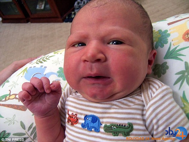 کودکانی که در نوزادی پیر هستند (تصاویر)