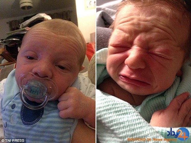 کودکانی که در نوزادی پیر هستند (تصاویر)