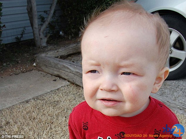 کودکانی که در نوزادی پیر هستند (تصاویر)