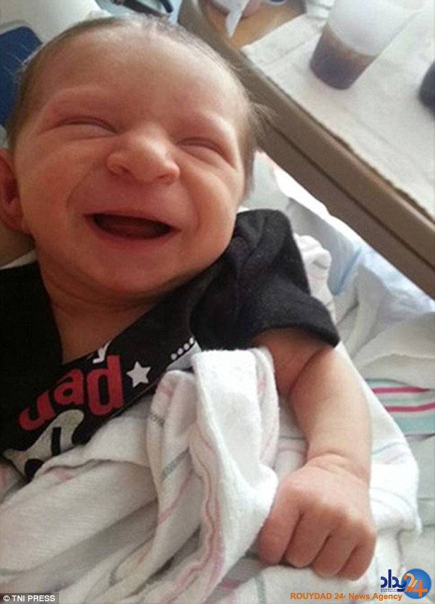 کودکانی که در نوزادی پیر هستند (تصاویر)