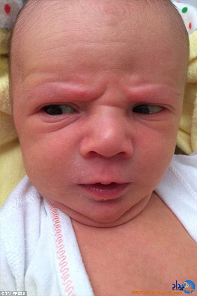 کودکانی که در نوزادی پیر هستند (تصاویر)