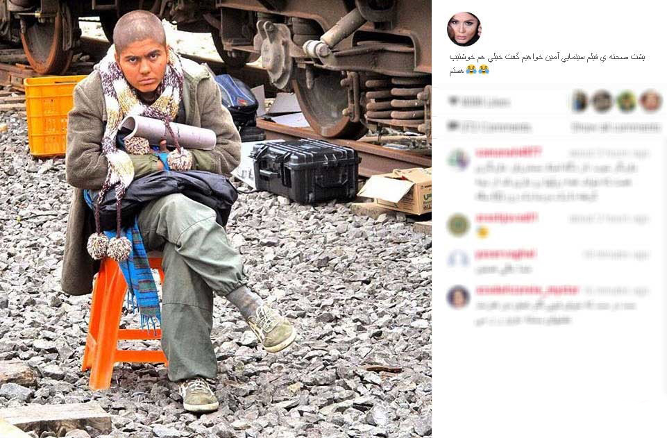 بازیگر زنی که کچل شد (تصویر)