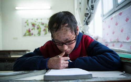 پولک ماهی بر تن رنجور جواد (تصاویر)