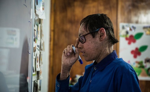 پولک ماهی بر تن رنجور جواد (تصاویر)