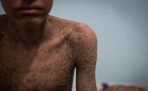 پولک ماهی بر تن رنجور جواد (تصاویر)