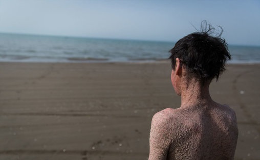 پولک ماهی بر تن رنجور جواد (تصاویر)