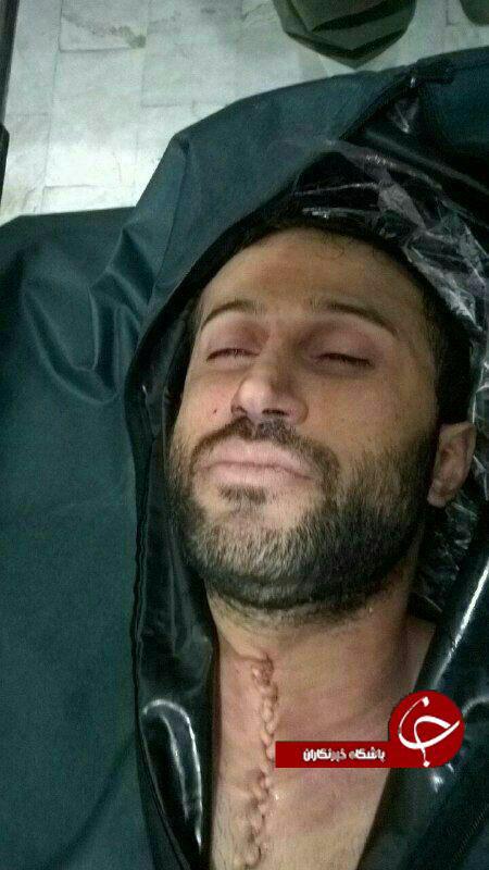 چهره و خواب آرام مهرداد اولادی پس از کالبد شکافی چهره و خواب آرام مهرداد اولادی پس از کالبد شکافی