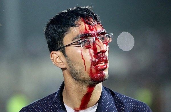 گزارش تصویری حوادث تلخ شب گذشته در وزرشگاه تختی اهواز گزارش تصویری حوادث تلخ شب گذشته در وزرشگاه تختی اهواز