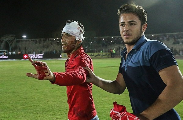 گزارش تصویری حوادث تلخ شب گذشته در وزرشگاه تختی اهواز گزارش تصویری حوادث تلخ شب گذشته در وزرشگاه تختی اهواز