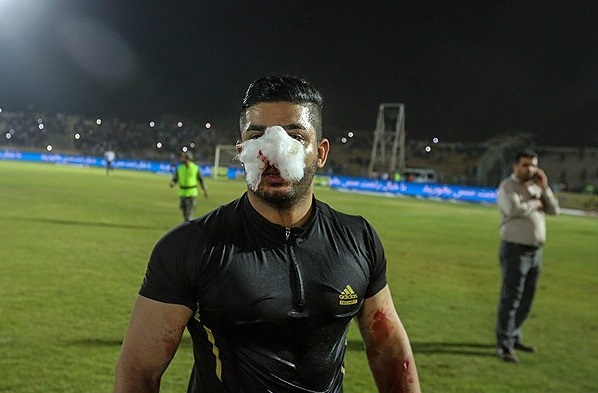 گزارش تصویری حوادث تلخ شب گذشته در وزرشگاه تختی اهواز گزارش تصویری حوادث تلخ شب گذشته در وزرشگاه تختی اهواز