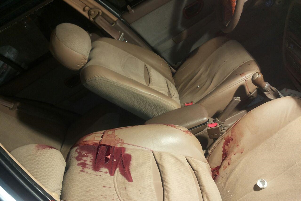 تیراندازی خونین در پارکینگ بیمارستان عرفان (تصاویر)
